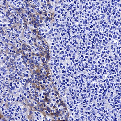 Jagged1 Recombinant Rabbit mAb (S-3296)