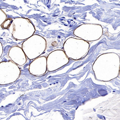 FASN Recombinant Rabbit mAb (S-682-32)
