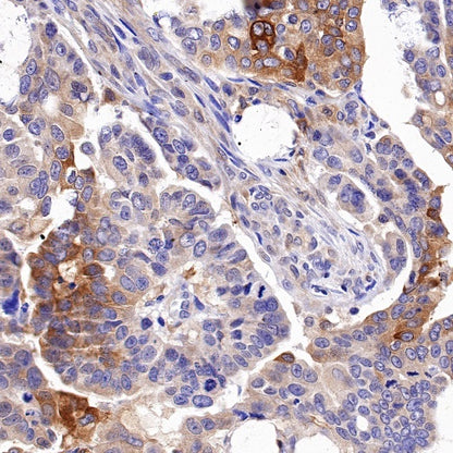 IFIT1 Recombinant Rabbit mAb (S-962-58)