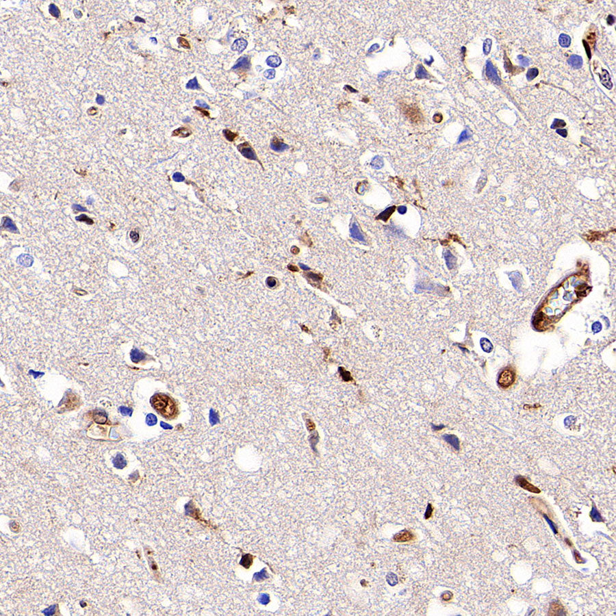PSMB9 Recombinant Rabbit mAb (S-4183-122)