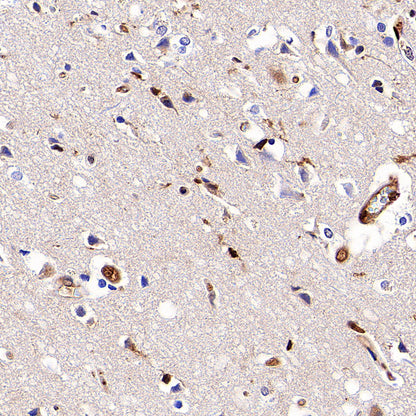 PSMB9 Recombinant Rabbit mAb (S-4183-122)