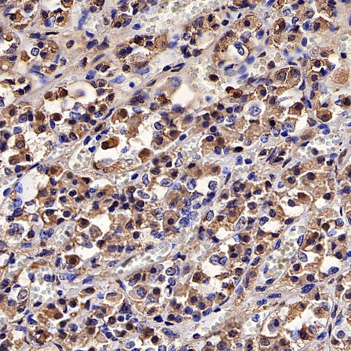 Human Growth Hormone / GH Recombinant Rabbit mAb (SDT-1160-40)