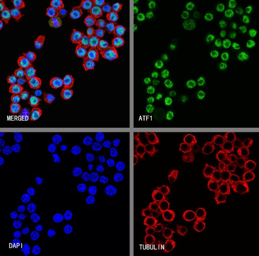 ATF1 Recombinant Rabbit mAb (S-2883-124)