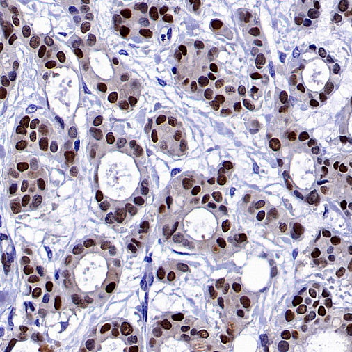 ER alpha Recombinant Rabbit mAb (SDT-2950-36)