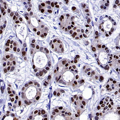ER alpha Recombinant Rabbit mAb (SDT-2950-36)