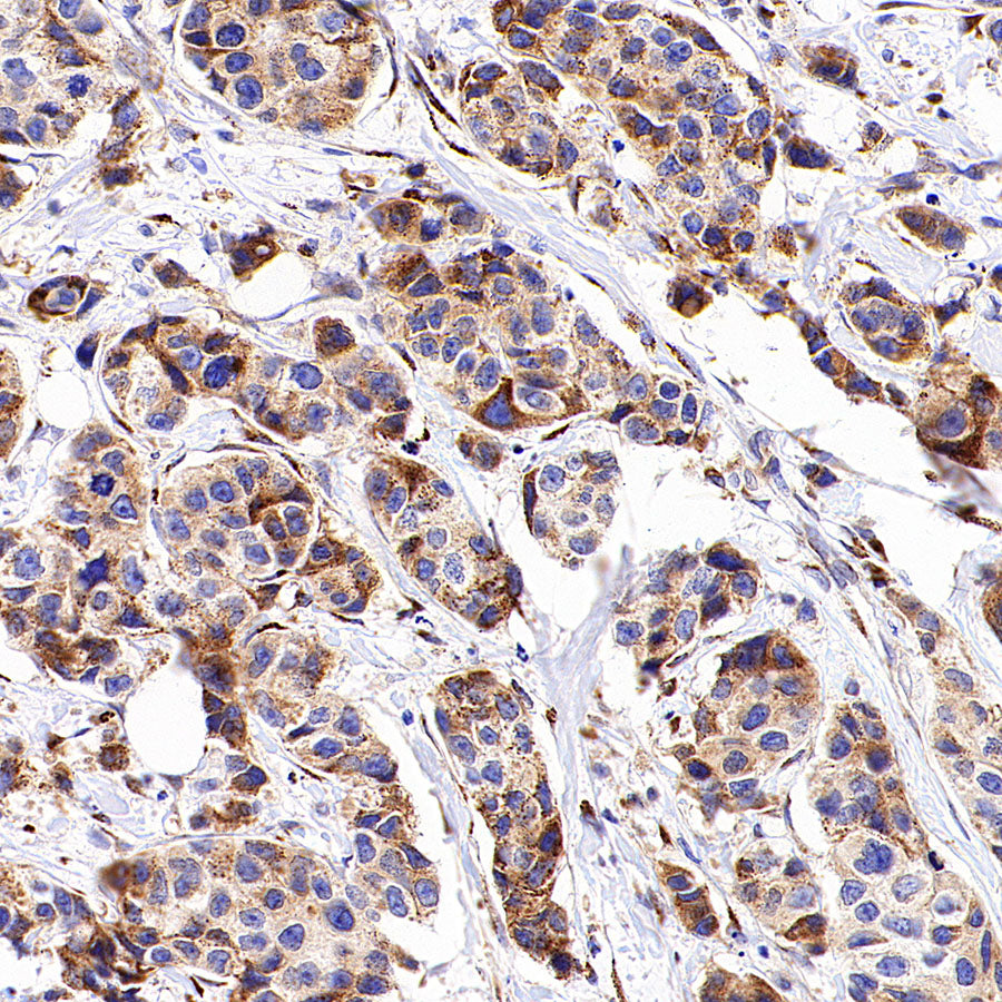 SPTLC1 Recombinant Rabbit mAb (S-6028)