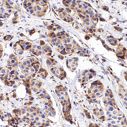 SPTLC1 Recombinant Rabbit mAb (S-6028)