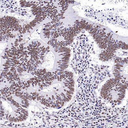 SMARCAL1 Recombinant Rabbit mAb (S-2110-328)