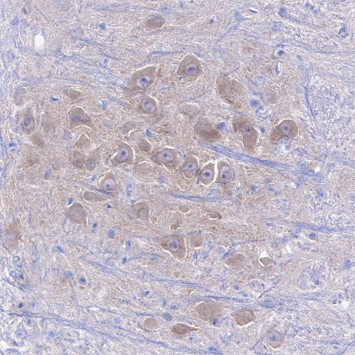 CaMKII-α/β Recombinant Rabbit mAb (S-R329)