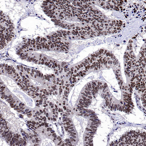 Fibrillarin Recombinant Rabbit mAb (S-1718-171)