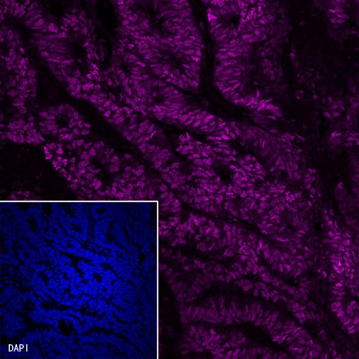 Progesterone Receptor Recombinant Rabbit mAb (Alex Fluor®647 Conjugate) (S-R123)