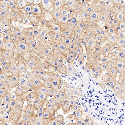 STEAP3 Recombinant Rabbit mAb (S-4466-26)