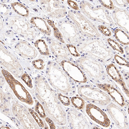 DRP1 Recombinant Rabbit mAb (S-1927-27)