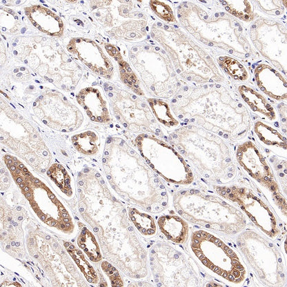 DRP1 Recombinant Rabbit mAb (S-1927-27)
