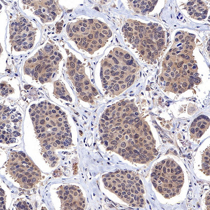 Akt (pan) Recombinant Rabbit mAb (S-652-20)