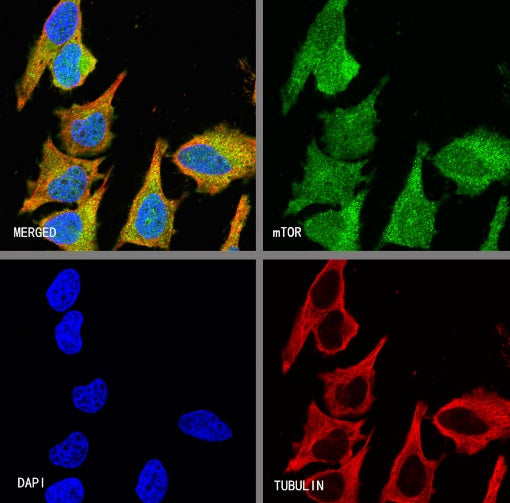 mTOR Recombinant Rabbit mAb (S-698-228)