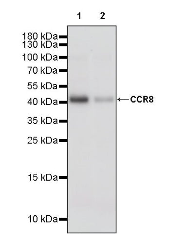 CCR8 Recombinant Rabbit mAb (S-1414-148)