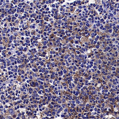 ITGB7 Recombinant Rabbit mAb (S-4138)