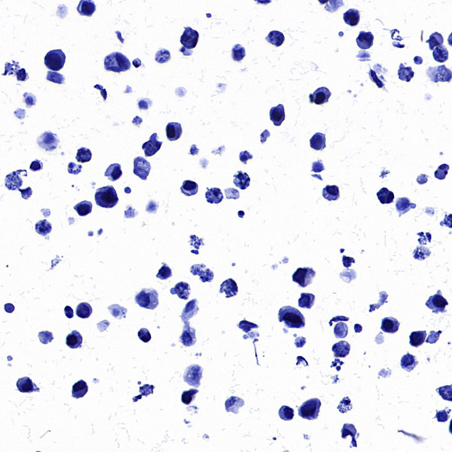STEAP1 Recombinant Rabbit mAb (S-3613-107)
