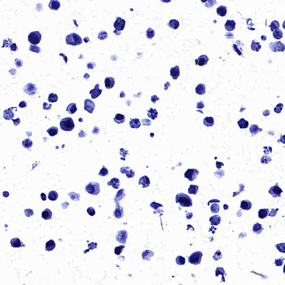 STEAP1 Recombinant Rabbit mAb (S-3613-107)