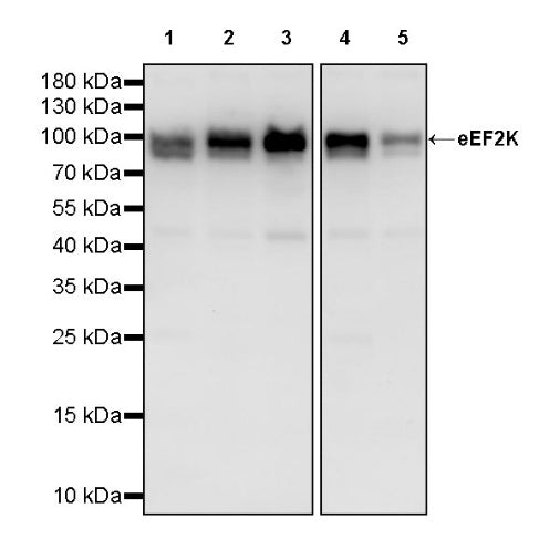 eEF2K Rabbit Polyclonal Antibody