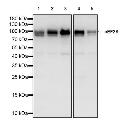 eEF2K Rabbit Polyclonal Antibody