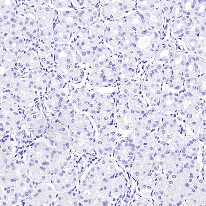MUC17 Recombinant Rabbit mAb (SDT-1415-49)