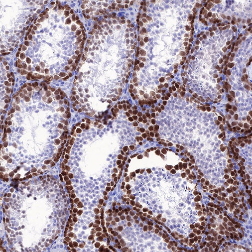 Rad51 Recombinant Rabbit mAb (S-R347)