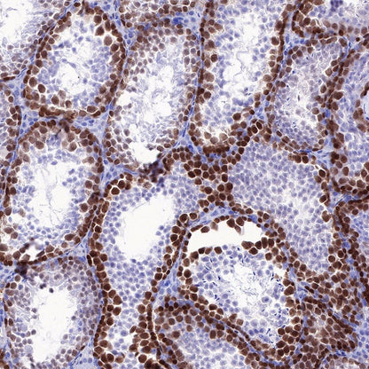 Rad51 Recombinant Rabbit mAb (S-R347)