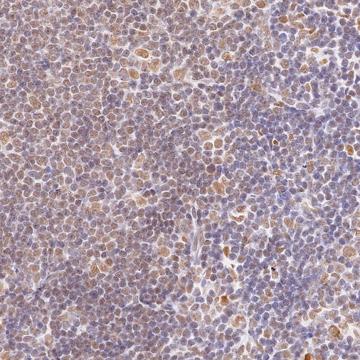 Cyclin K Recombinant Rabbit mAb (S-1586-18)