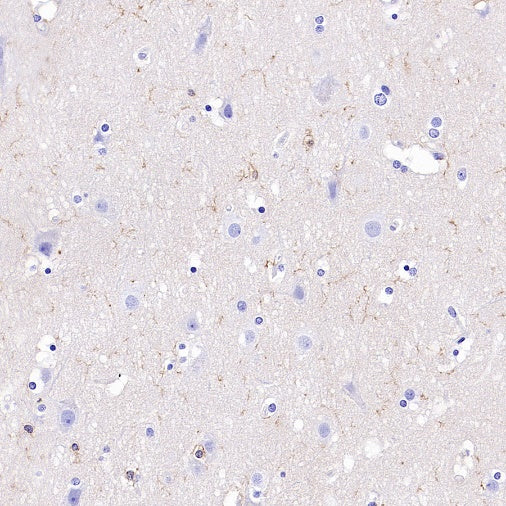NINJ1 Recombinant Rabbit mAb (S-3109-56)