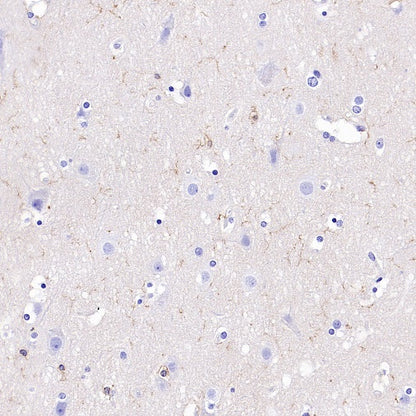 NINJ1 Recombinant Rabbit mAb (S-3109-56)