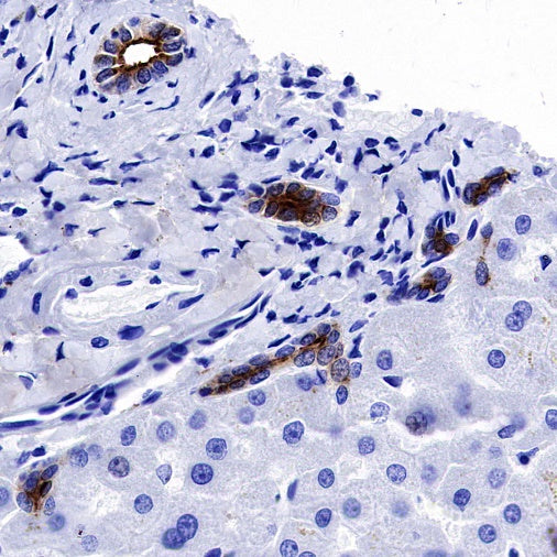 Osteopontin Recombinant Rabbit mAb (S-1005-50)