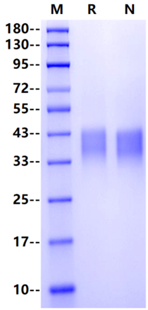 TSLPR His Tag Protein, Human