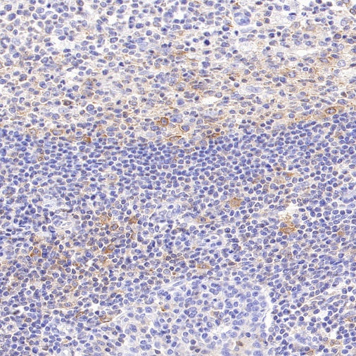 Jak3 Recombinant Rabbit mAb (S-4219)