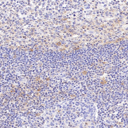 Jak3 Recombinant Rabbit mAb (S-4219)