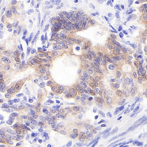 S-RMab® ErbB3 Recombinant Rabbit mAb (SDT-991-10)
