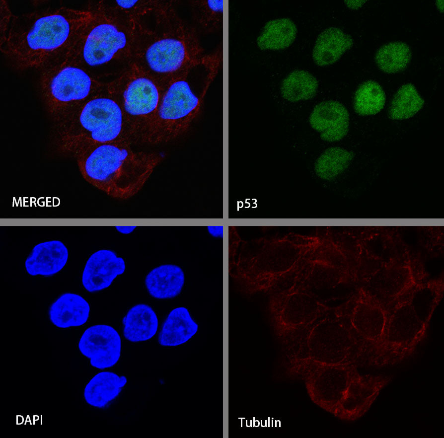 S-RMab® p53 Recombinant Rabbit mAb (SDT-R118)