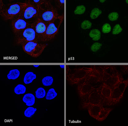 S-RMab® p53 Recombinant Rabbit mAb (SDT-R118)