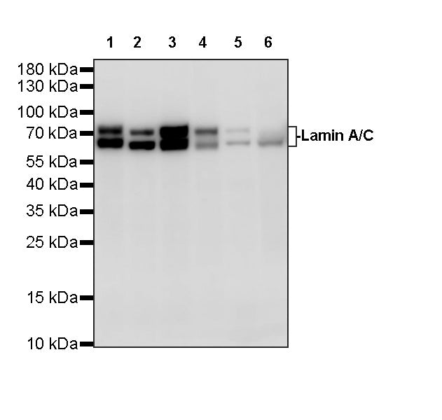 Lamin A/C Recombinant Rabbit mAb (S-5671)