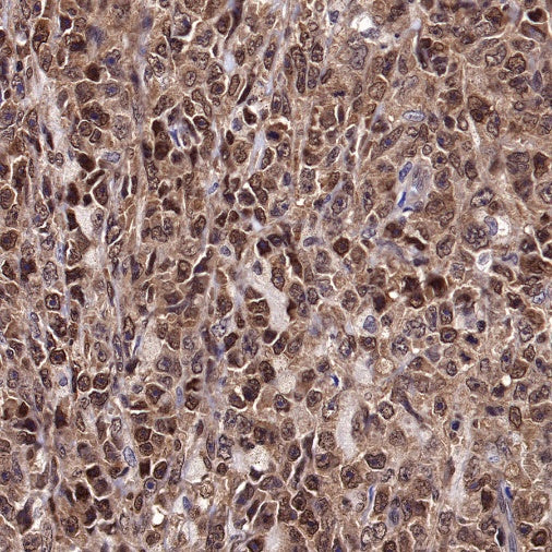 MGMT Recombinant Rabbit mAb (SDT-522-71)