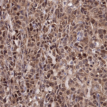 MGMT Recombinant Rabbit mAb (SDT-522-71)