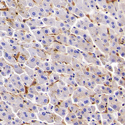 HLA-ABC Recombinant Rabbit mAb (S-3995-2)