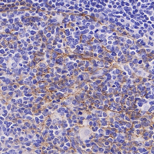 LICAM Recombinant Rabbit mAb, PBS Only (SDT-2594-39)