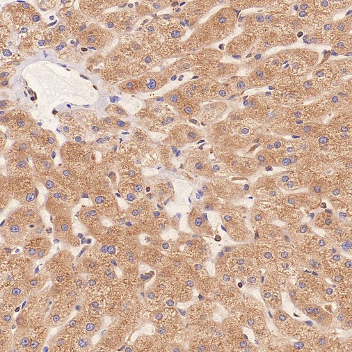 ERAP1 Recombinant Rabbit mAb (S-2509-38)
