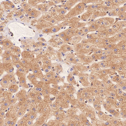 ERAP1 Recombinant Rabbit mAb (S-2509-38)