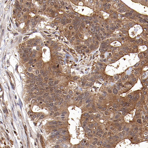 L-Lactate Dehydrogenase A/LDHA Rabbit Polyclonal Antibody