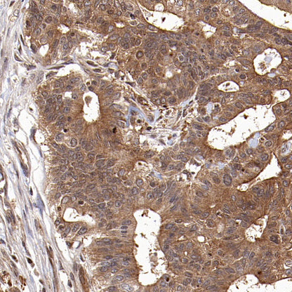 L-Lactate Dehydrogenase A/LDHA Rabbit Polyclonal Antibody