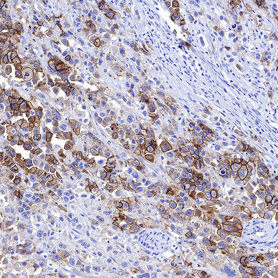 CDH17 Recombinant Rabbit mAb (SDT-3276-46)