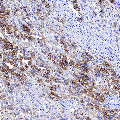 CDH17 Recombinant Rabbit mAb (SDT-3276-46)